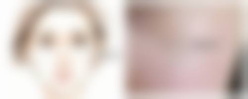 自体脂肪丰臀多久修复知觉