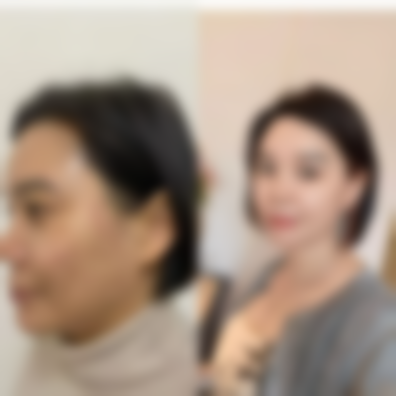 打完瘦脸针注意事项有哪些呢