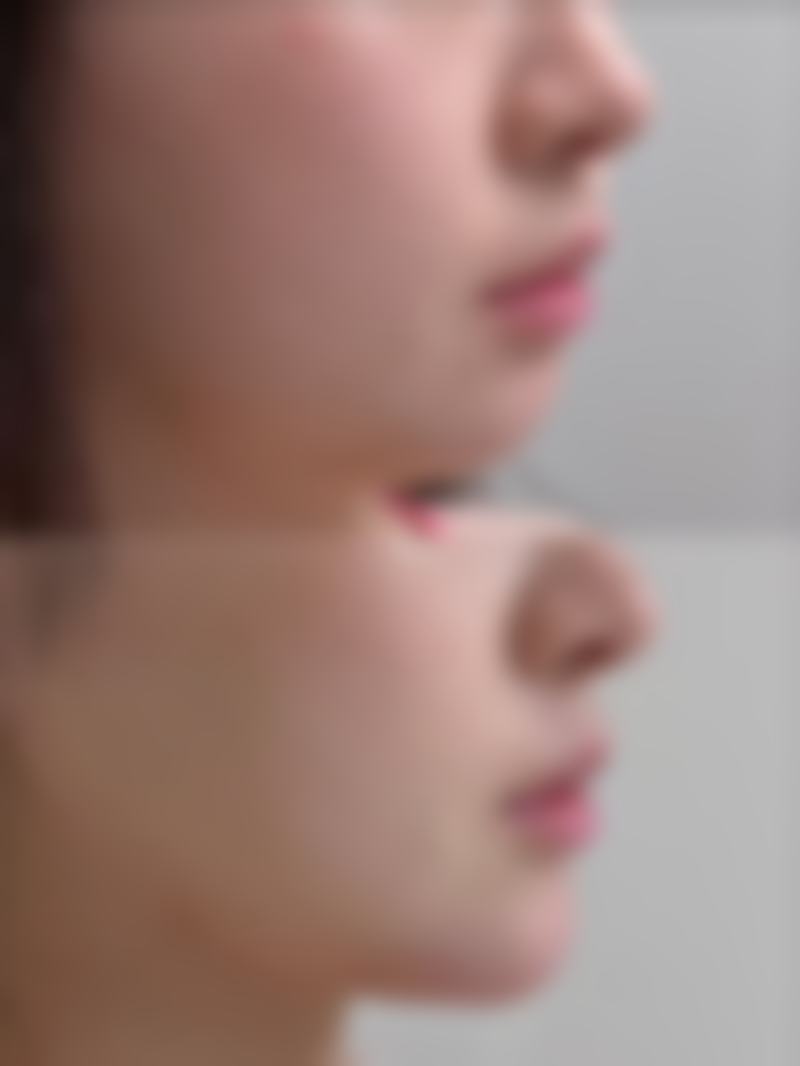 【衢州市人民医院整形美容科特色项目:】