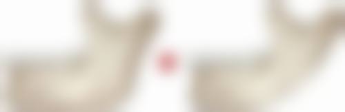 国产瘦脸针好用吗