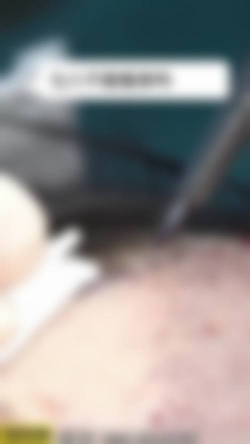 【重庆时光焕发植发医院核心优势：】