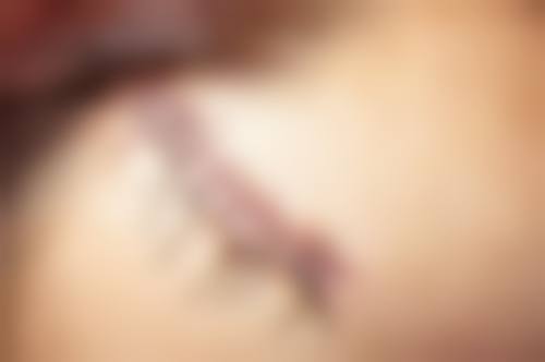 【邹家旋医生口碑】