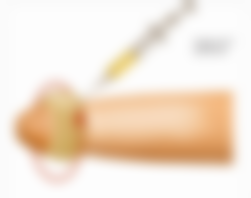 打了瘦脸针可以侧睡吗