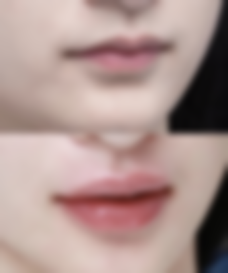 【宿迁黎明整形医院参考价格表:】