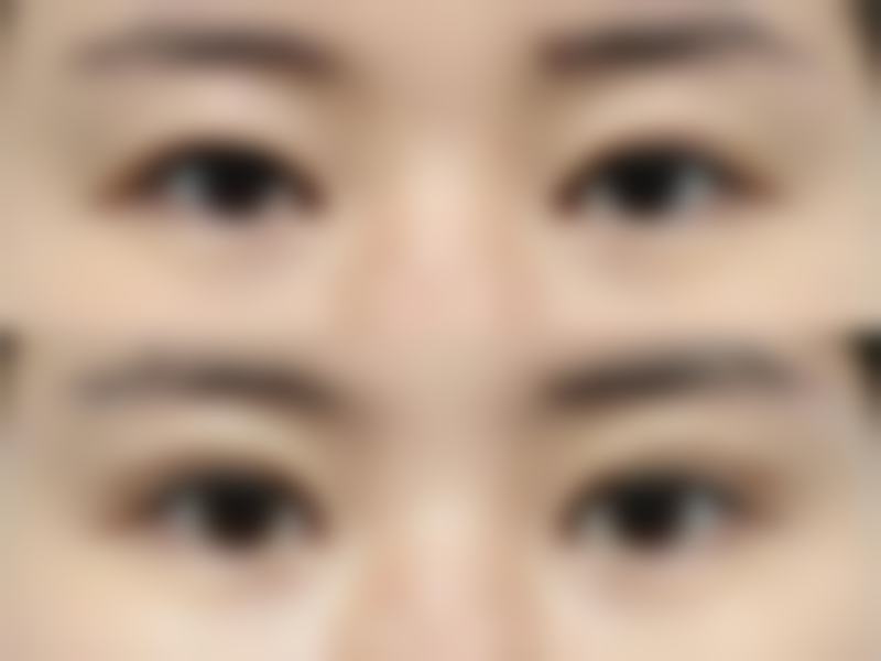 1. 之前一直对自己的鼻子不太满意，在朋友的推荐下来到了太原新塑美美容整形门诊做了鼻部综合整形。手术过程特别顺利，医生技术真的特别棒，术后修复也特别快，现在鼻子的形态非常自然，我特别满意，真的感谢这里的医生和医护人员。