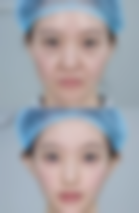 【南京维秀医疗美容诊所参考价格表:】