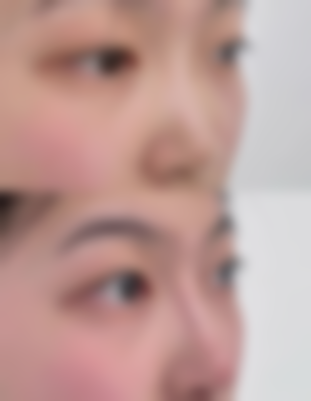 嘴巴一边大一边小该怎样睡