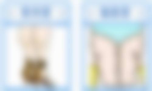 打瘦脸针多少钱一次