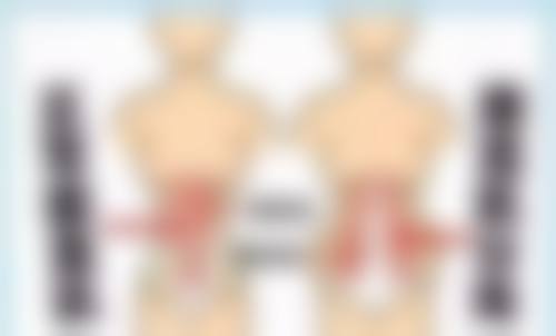 打瘦脸针会垮脸吗