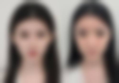 【韩国moonclinic整形外科医院患者口碑评价:】