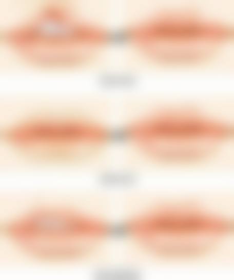 【秦皇岛巧致整形医院患者口碑评价:】