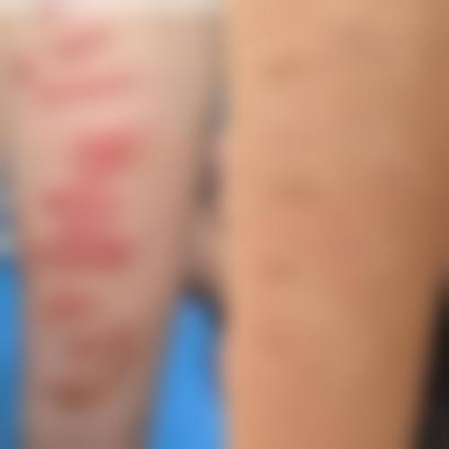 【成都锦江格莱丽医疗美容门诊部是正规的吗?】