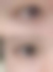 【合肥斯尔美医疗美容门诊部特色项目:】