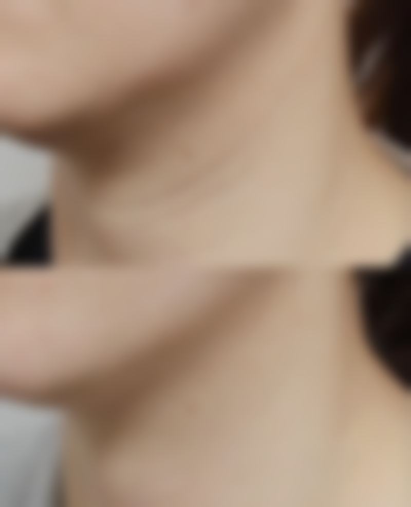 副作用大小及持续时长