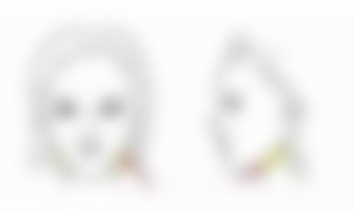 做手术让嘴唇变薄