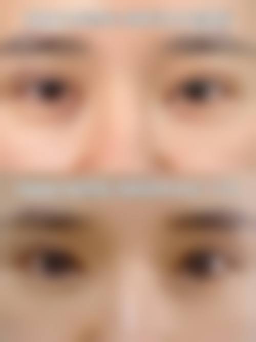 以下是部分项目的参考价格表，价格仅供参考，实际以到院面诊为准。