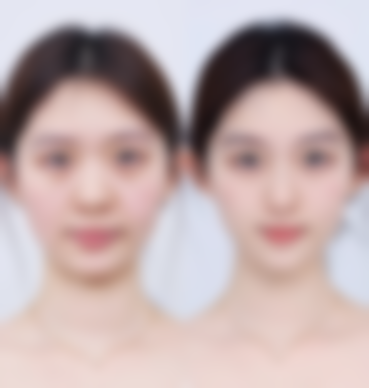 【北京文峰美容美发医院怎么预约挂号?】