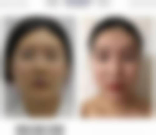 上唇厚下唇薄的女人是怎样形成的,与下唇厚上唇薄的女人对比,上唇厚下唇薄又好不好?