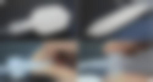 玻尿酸除皱效果好不好？揭秘！90%体验者反馈效果显著，轻松抚平皱纹重拾年轻肌肤！ 