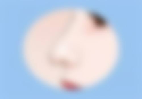 下巴整形风险有多大