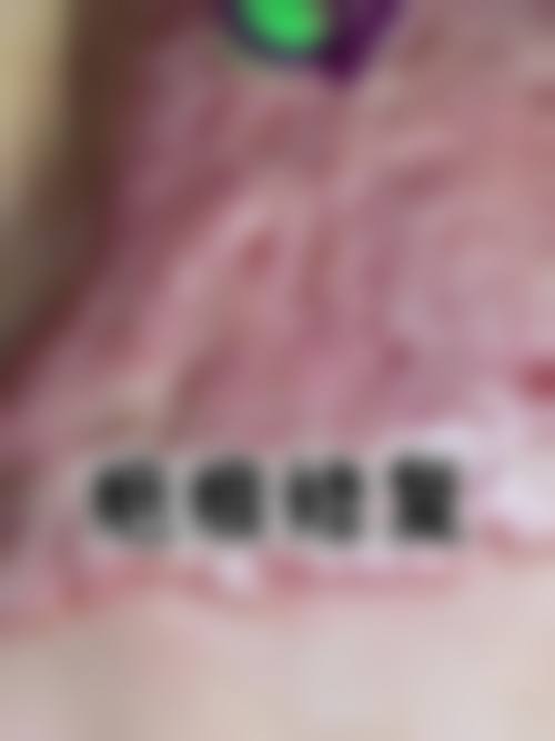 1. 之前在邹城市妇幼保健计划生育服务中 心医疗美容科做了双眼皮手术,成效真的太棒了!医生技术特别厉害,手术过程中也没有感觉到特别疼。术后修复得也特别快,现在眼睛变得又大又漂亮,真的特别感谢这里的医生和护士们。