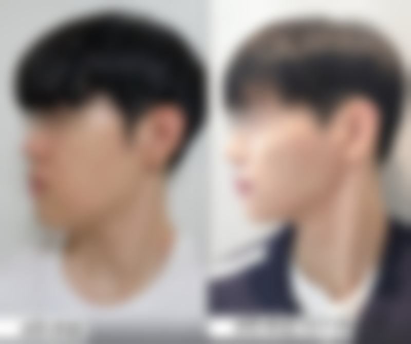 杭州悦可医疗美容诊所熊员平医生的口碑怎么样