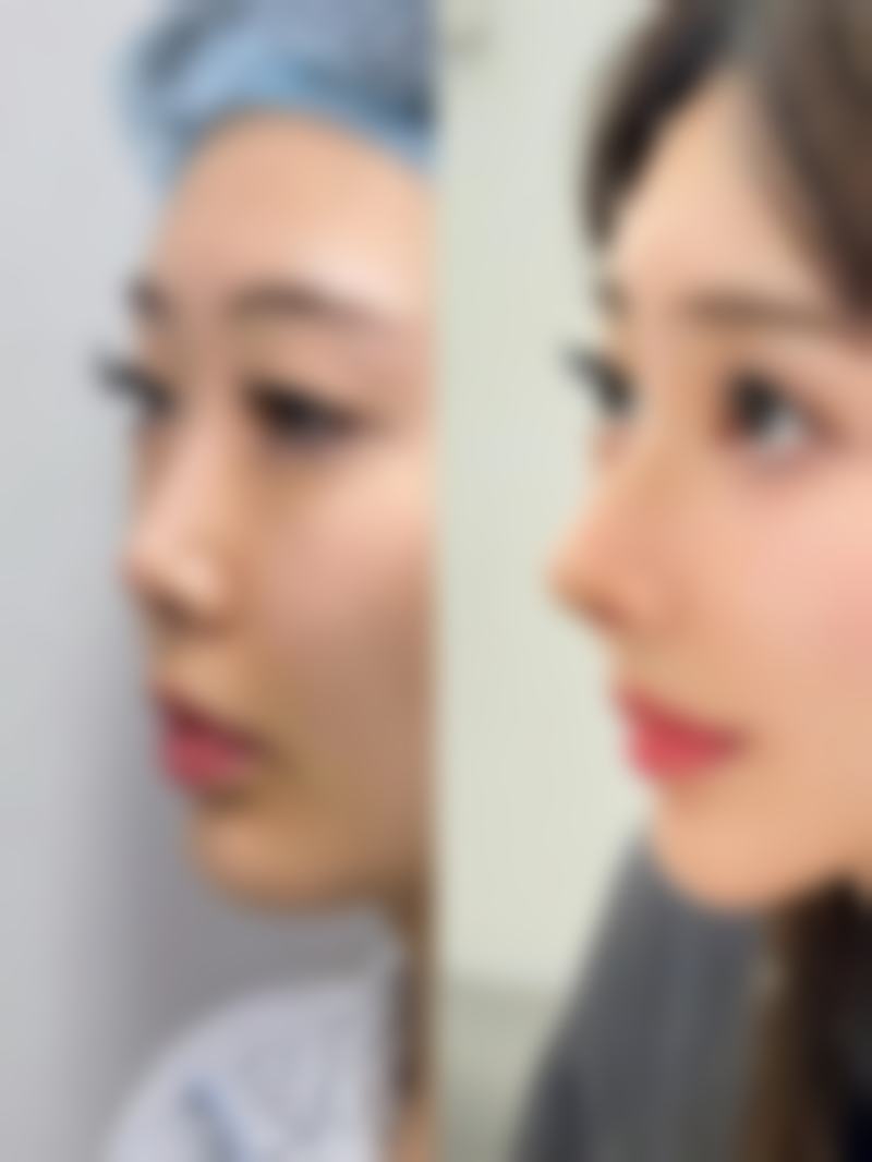 【广州圣心微美整形医疗美容医院诊疗设备：】