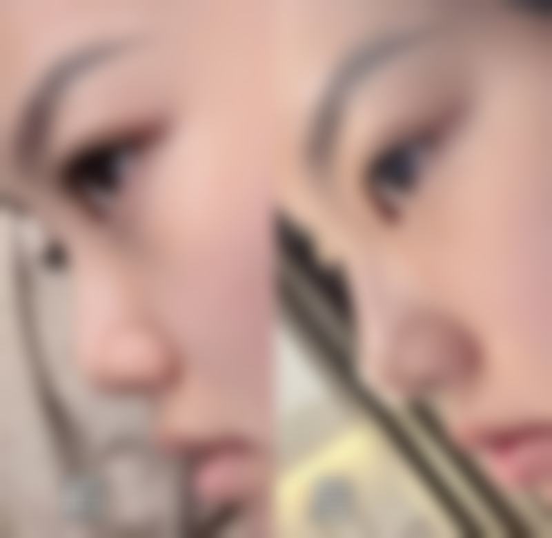 【深圳暨南大学附属深圳华侨医院整形科诊疗设备：】