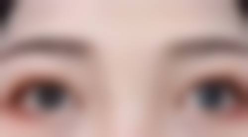 因为张嘴睡觉导致的凸嘴还可以矫正吗？医美矫正效果显著，3大方法助你轻松告别凸嘴重拾自信！ 