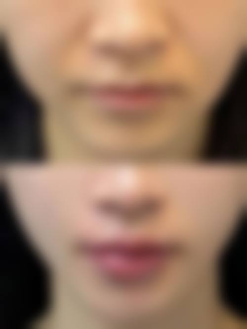 【娄底鸿泰皮肤医疗美容诊所参考价格表：】