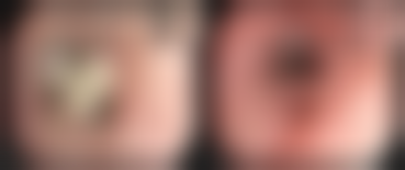 【娄底鸿泰皮肤医疗美容诊所诊疗设备：】