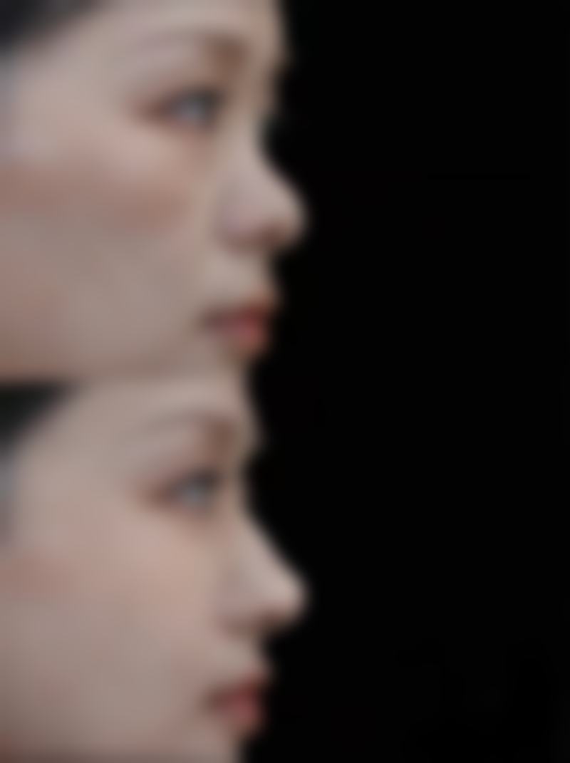 瘦脸针打几次就恒久了