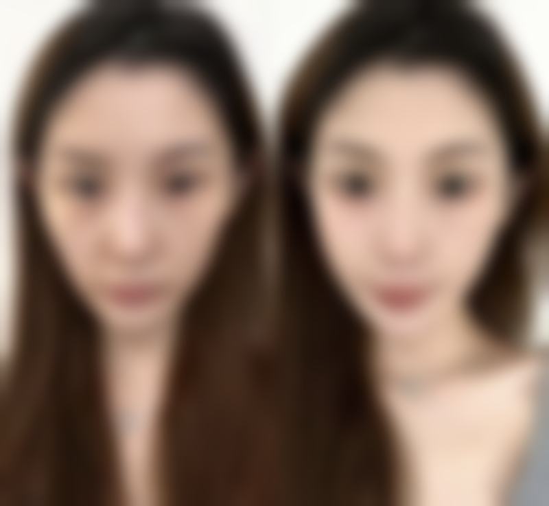 有必要做阴道紧缩术吗？了解3大好处，助你提升生活质量、改善健康状况、重获自信魅力！ 