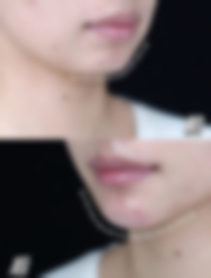 【大理伊美东方丽人医疗美容特色项目:】