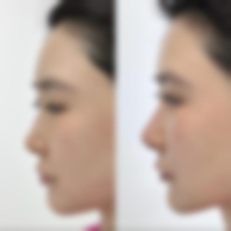 【天桥徐晶整形美容诊所患者口碑评价:】