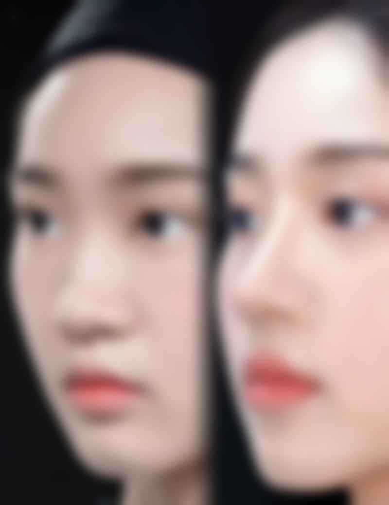 1. 之前在嘉和做了半长久纹眼线,成效真的太棒了!医生技术特别娴熟,纹出来的眼线自然又好看,而且整个过程一点都不疼,服务也非常贴心,以后还会再来的。