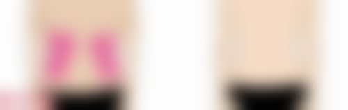 头发种植后的注意事项