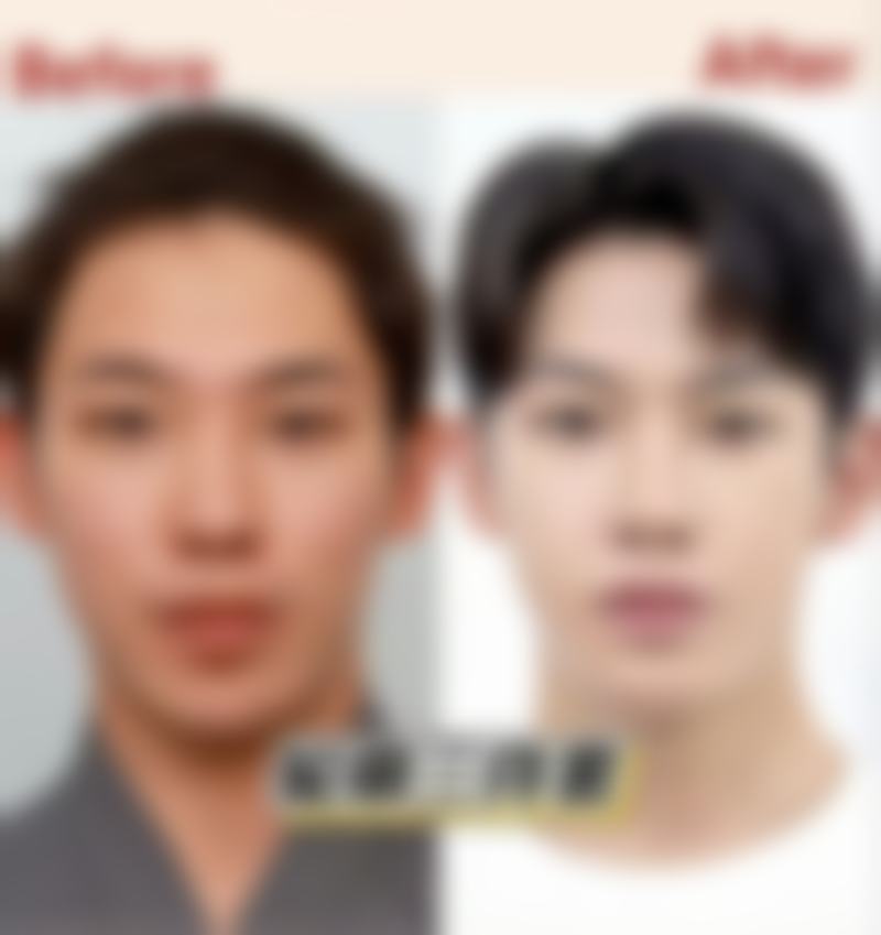 美白针可维持多久？揭秘3大影响因素，掌握正确护理方法让美白效果延长至1-2年！ 