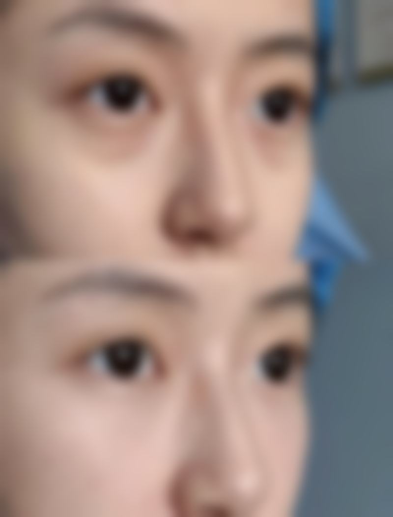 【潍坊美神整形美容医院怎么预约挂号?】