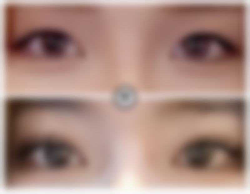 【张敏珠医生口碑怎么样？】