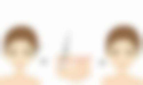 咬肌不大的人打瘦脸针管用吗