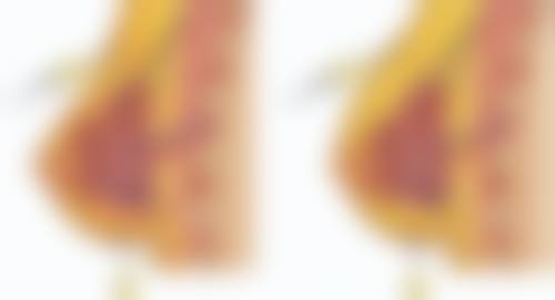 头发种植后毛囊多久可以存活