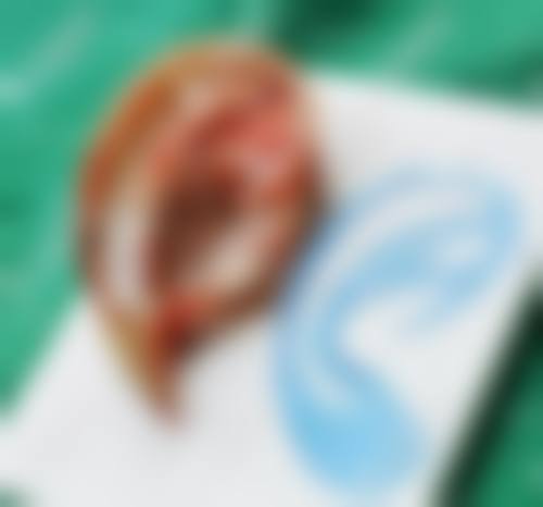 【绵阳市人民医院整形外科是正规的吗?】