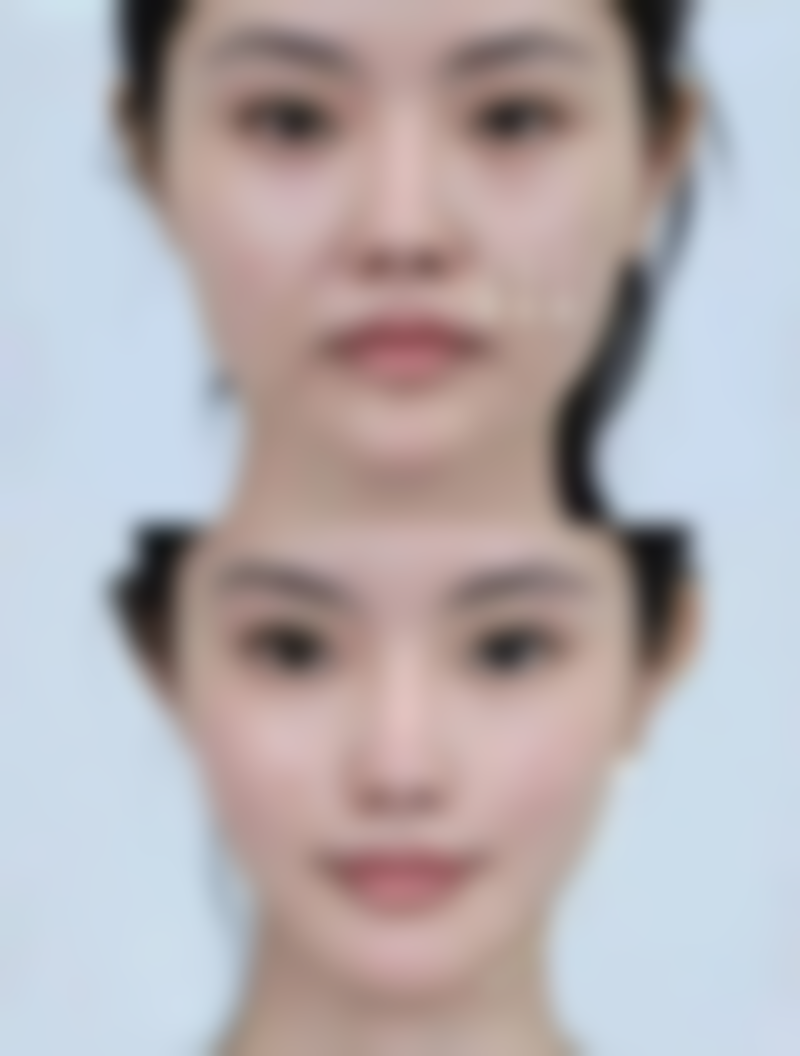 能用别人的头发吗