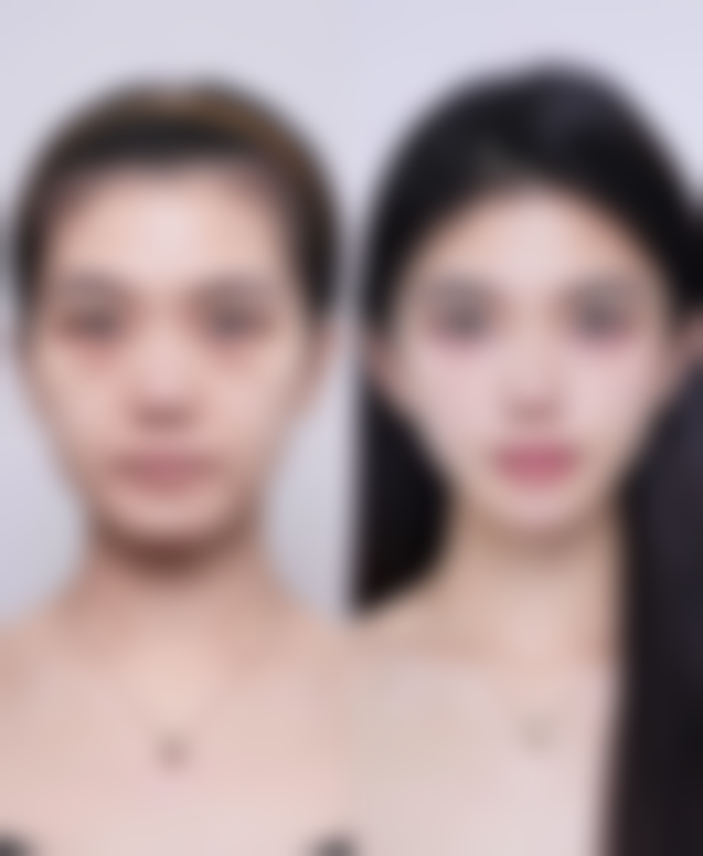 【李靖雯医生擅长项目:】