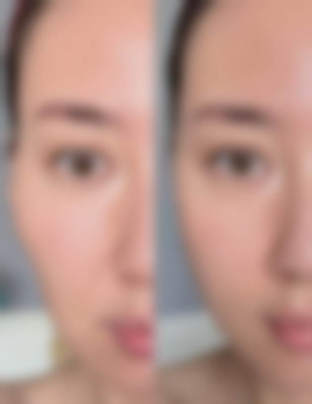 瘦脸针白肉和粉肉哪个贵