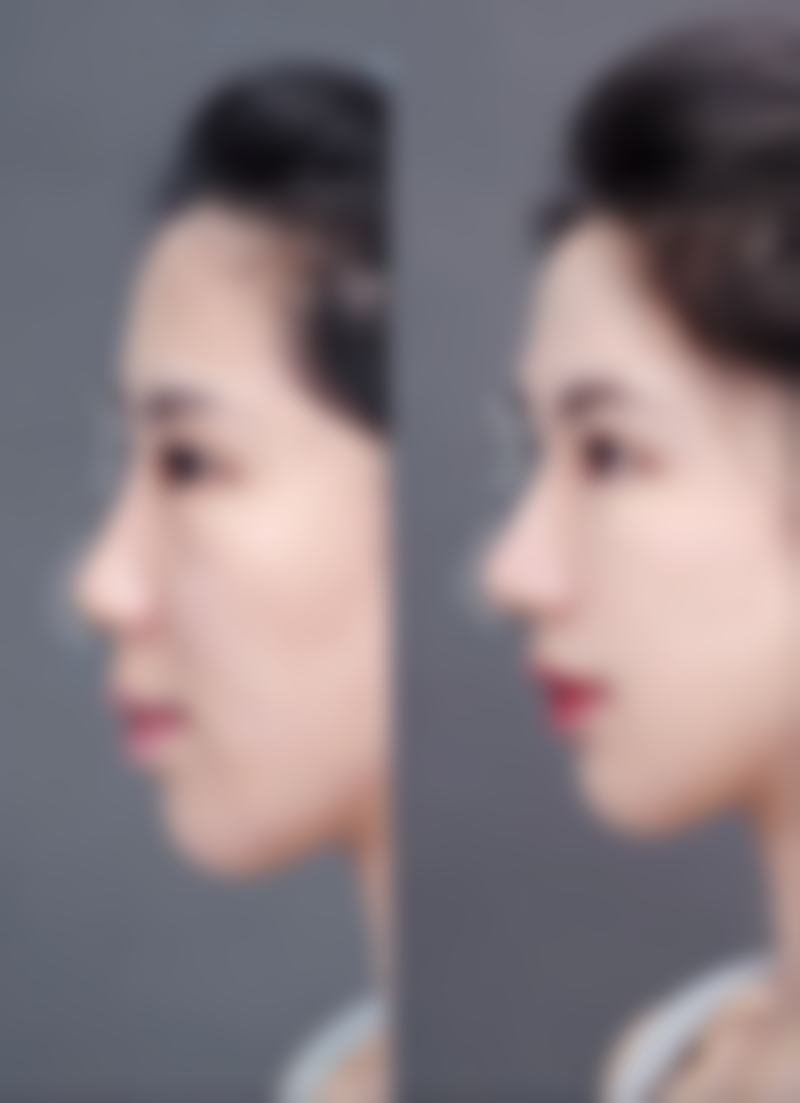 2. 我做了韩式半恒久纹眉，成效超出了我的预期。纹眉的医生技术特别娴熟，根据我的脸型和五官设计了非常适合我的眉形。现在每天都不用花时间画眉毛了，感觉生活都方便了特别多。