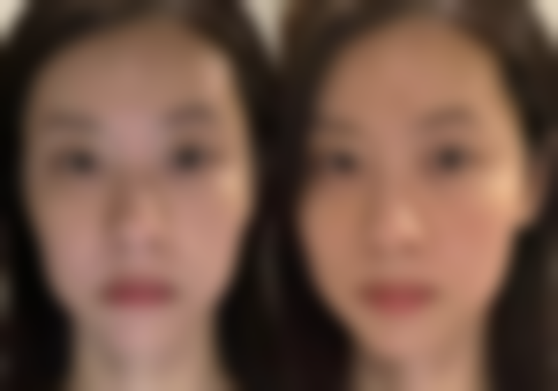 成都双楠医院整形美容科的特色项目可真是丰富多彩。有能让人重返青春的童颜术，仿佛能把时光的痕迹轻轻抹去；纯韩面部吸脂术，让你的脸部线条更加精致；内窥镜筋膜下隆胸，为女性塑造更加理想的身材曲线；光子刀鼻综合整形，让你的鼻子更加立体美观；激光祛眼袋，轻松解决眼部的烦恼；面部吸脂可以让脸部更加小巧玲珑；电波拉皮能有效紧致肌肤；下颌角整形、改脸型能让你的脸型更加符合美学标准；鼻再造为鼻子有缺陷的人带来新的希望；除皱可以减少岁月留下的皱纹；韩式半恒久纹眉、半恒久睫毛线让你省去每天化妆的麻烦；垫鼻尖、自体脂肪隆鼻能让鼻子更加挺拔。