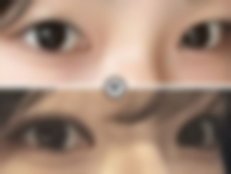 3. 医院的服务真的没话说，从预约到治疗，每一个环节都有人贴心地引导。我做的自体脂肪隆鼻，现在鼻子变得又高又挺，整个人的魅力都提升了不少。强烈推荐大家来这里。