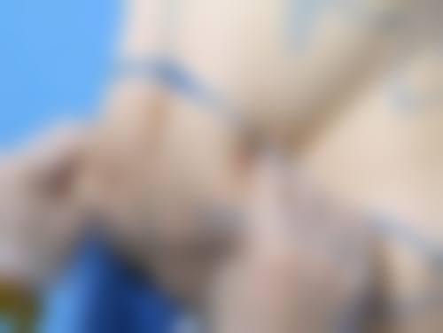 术后护理要点